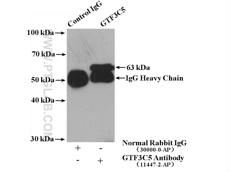 Immunoprecipitation (IP) experiment of mouse lung tissue using GTF3C5 Polyclonal antibody (11447-2-AP)