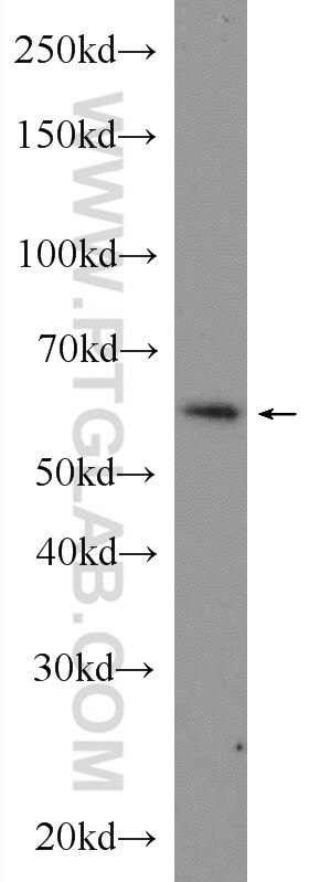 Western Blot (WB) analysis of mouse lung tissue using GTF3C5 Polyclonal antibody (11447-2-AP)