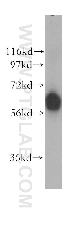 Western Blot (WB) analysis of human lung tissue using GTF3C5 Polyclonal antibody (11447-2-AP)