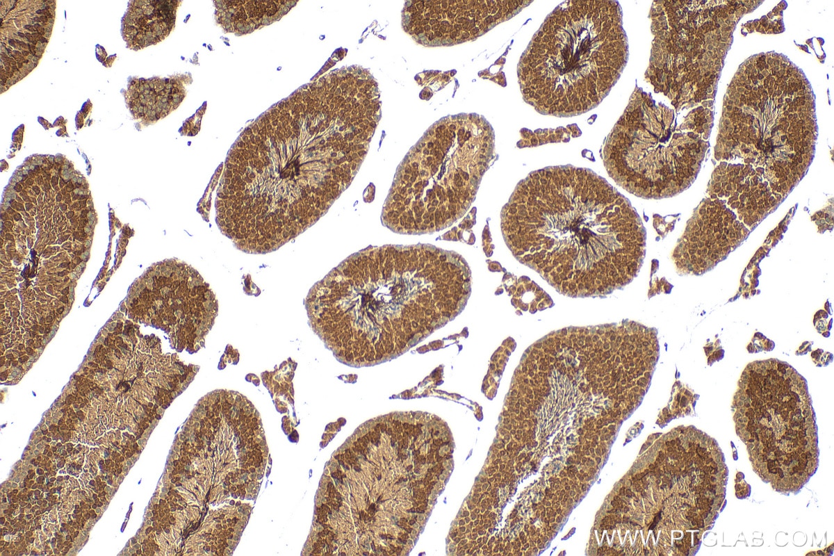 Immunohistochemistry (IHC) staining of mouse testis tissue using GTL3 Polyclonal antibody (19905-1-AP)
