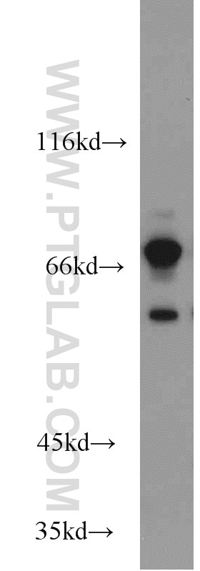 Western Blot (WB) analysis of mouse skeletal muscle tissue using GTPBP1 Polyclonal antibody (16374-1-AP)