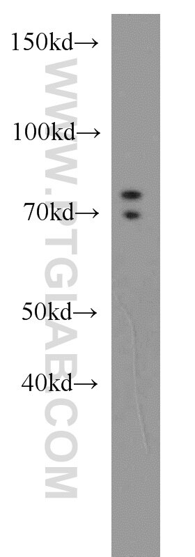 Western Blot (WB) analysis of Jurkat cells using GTPBP1 Polyclonal antibody (16374-1-AP)