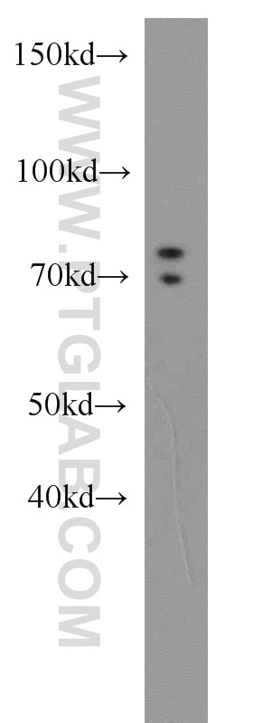Western Blot (WB) analysis of Jurkat cells using GTPBP1 Polyclonal antibody (16374-1-AP)