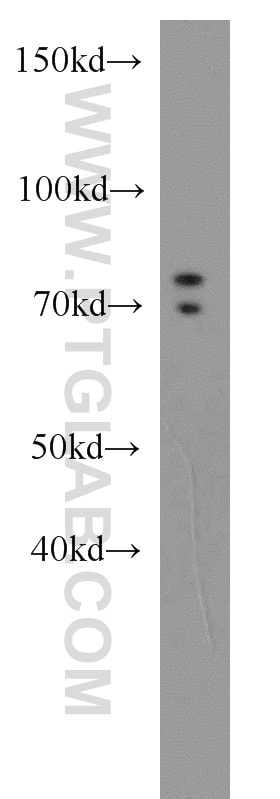 WB analysis of Jurkat using 16374-1-AP