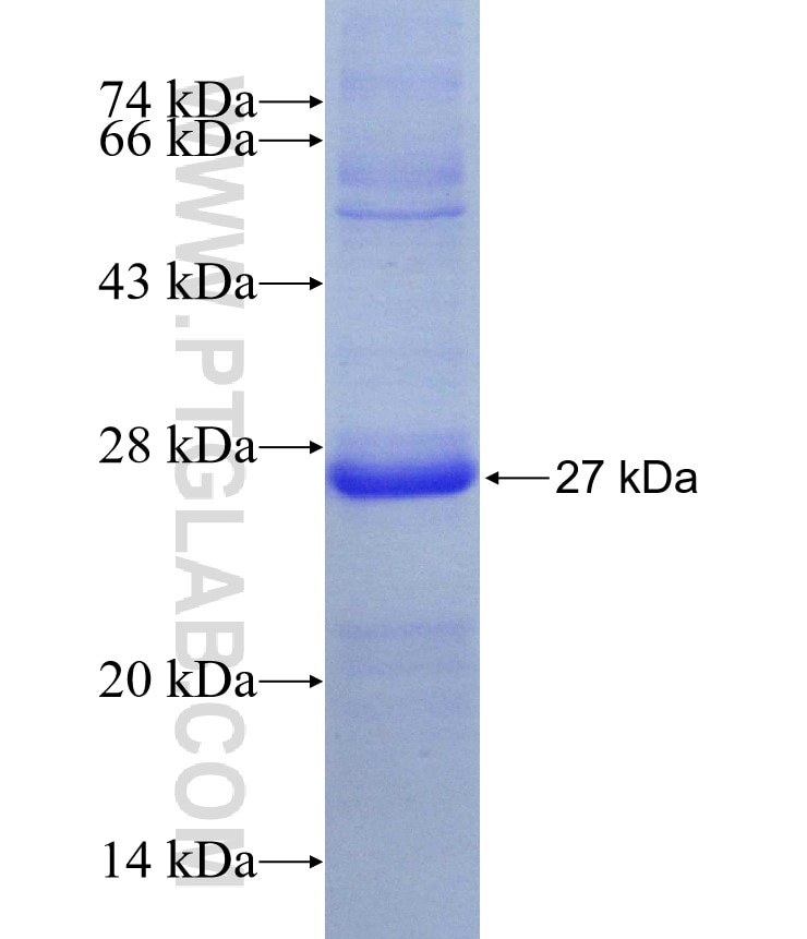 GTPBP1 fusion protein Ag9238 SDS-PAGE