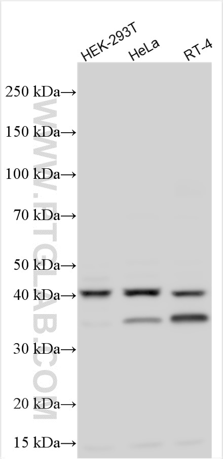Various lysates were subjected to SDS PAGE followed by western blot with 32944-1-AP (GTPBP10 antibody) at dilution of 1:1000 incubated at room temperature for 1.5 hours. Western Blot (WB) analysis of various lysates using GTPBP10 Polyclonal antibody (32944-1-AP)