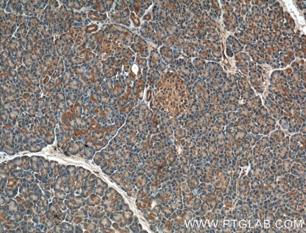 Immunohistochemistry (IHC) staining of human pancreas tissue using GTPBP2 Polyclonal antibody (11557-1-AP)