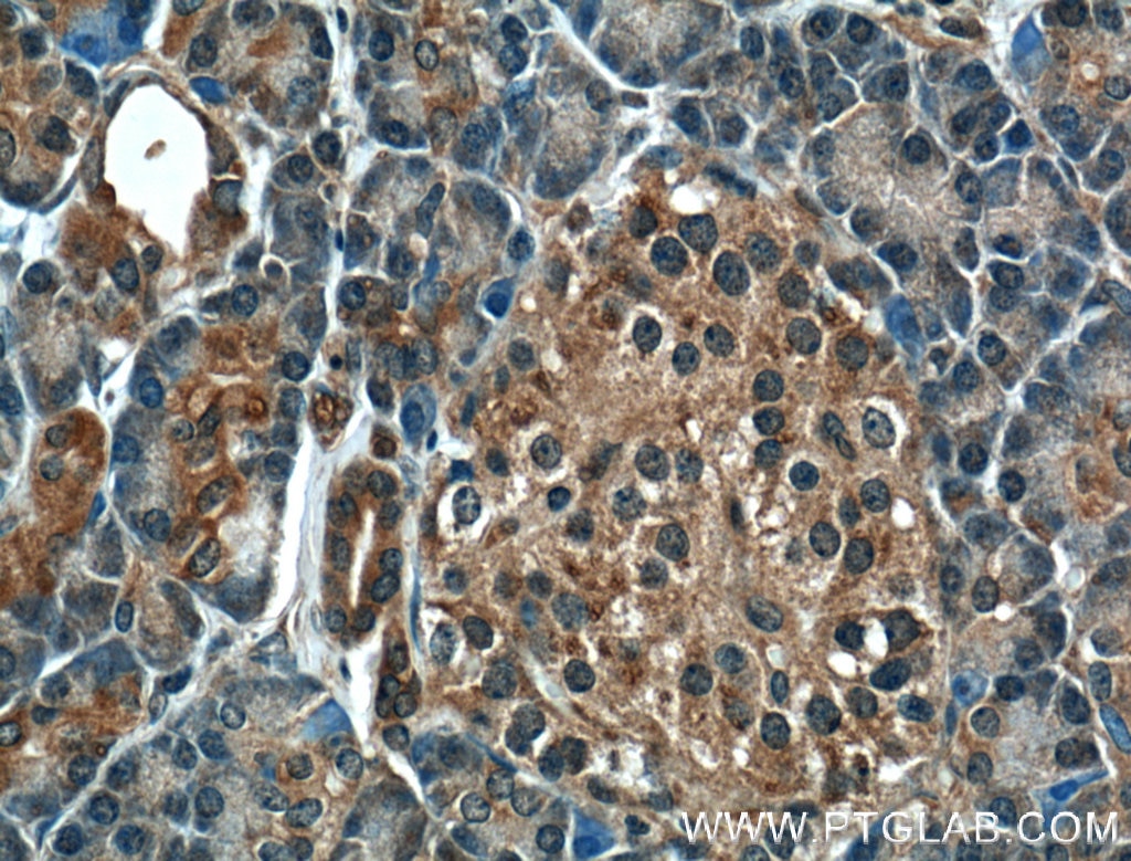 Immunohistochemistry (IHC) staining of human pancreas tissue using GTPBP2 Polyclonal antibody (11557-1-AP)