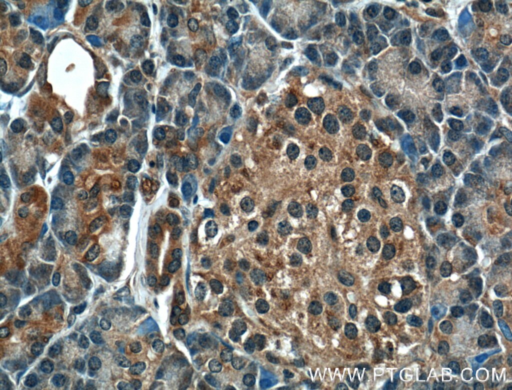 IHC staining of human pancreas using 11557-1-AP