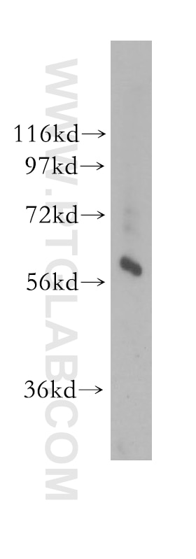 Western Blot (WB) analysis of human kidney tissue using GTPBP2 Polyclonal antibody (11557-1-AP)