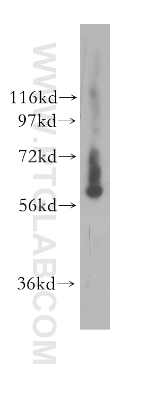 Western Blot (WB) analysis of human spleen tissue using GTPBP2 Polyclonal antibody (11557-1-AP)
