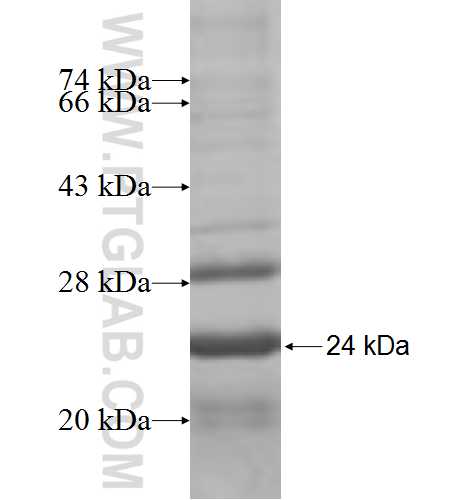 GTPBP2 fusion protein Ag7432 SDS-PAGE