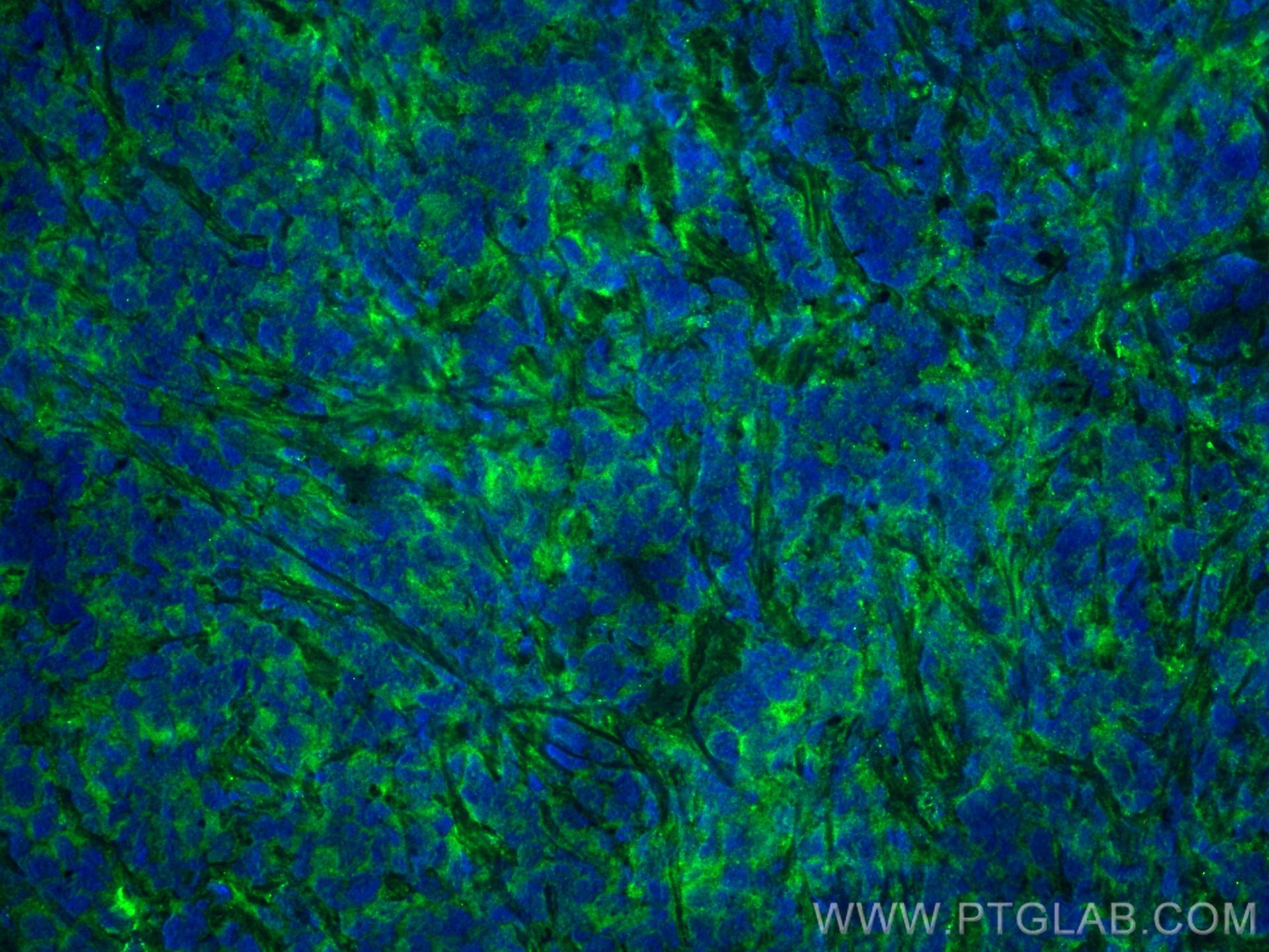 Immunofluorescence (IF) / fluorescent staining of mouse breast cancer using GTPBP3 Polyclonal antibody (10764-1-AP)