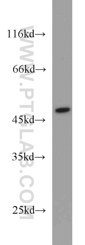 Western Blot (WB) analysis of Jurkat cells using GTPBP3 Polyclonal antibody (10764-1-AP)