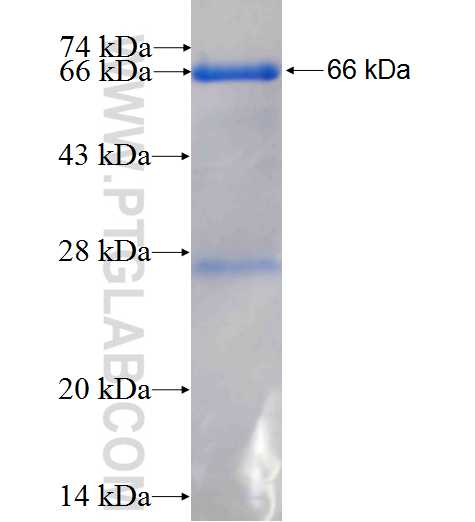 GTPBP3 fusion protein Ag1198 SDS-PAGE