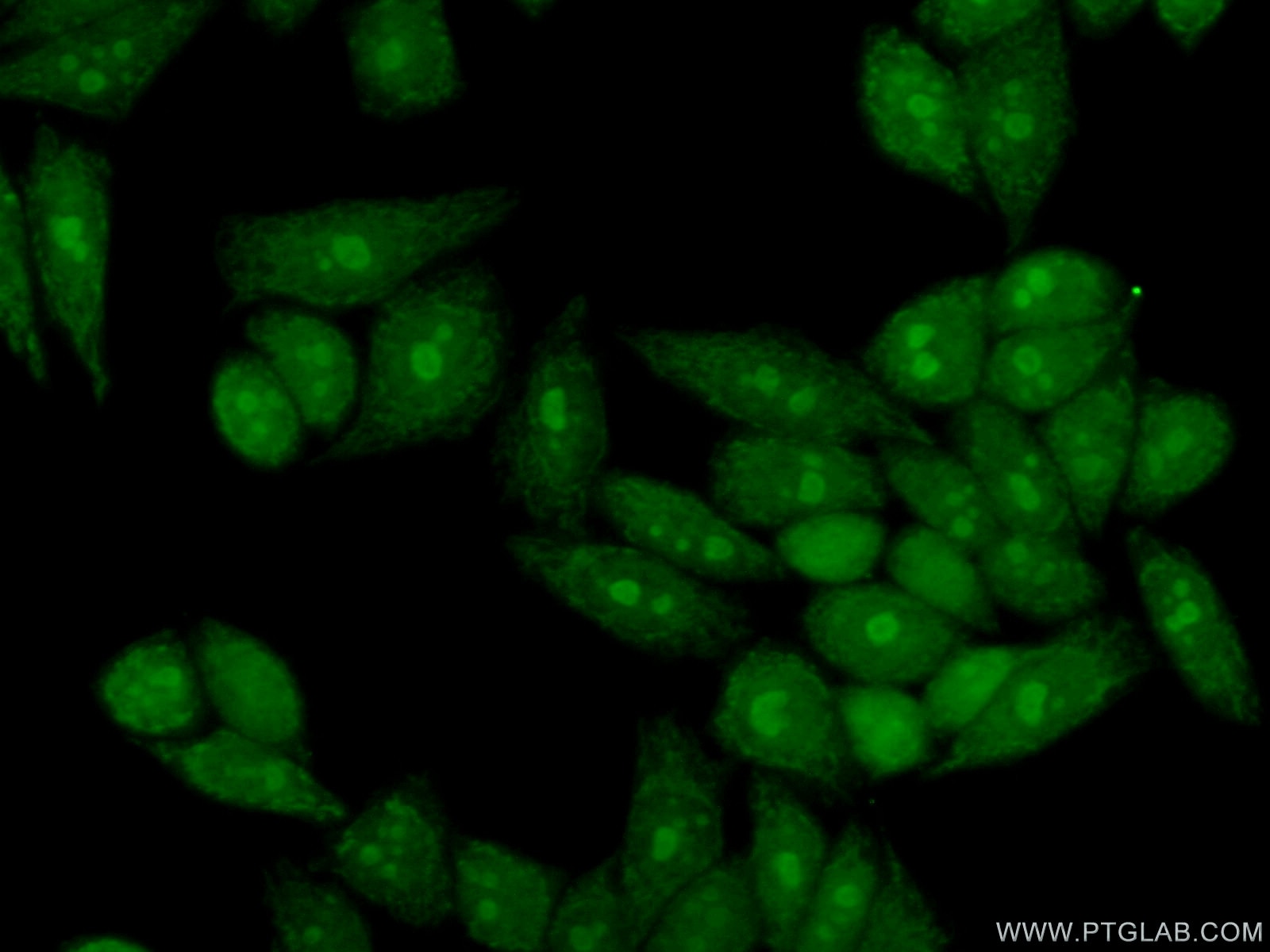 Immunofluorescence (IF) / fluorescent staining of HeLa cells using GTPBP4 Polyclonal antibody (13897-1-AP)