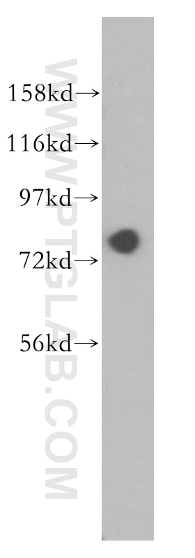 Western Blot (WB) analysis of mouse testis tissue using GTPBP4 Polyclonal antibody (13897-1-AP)