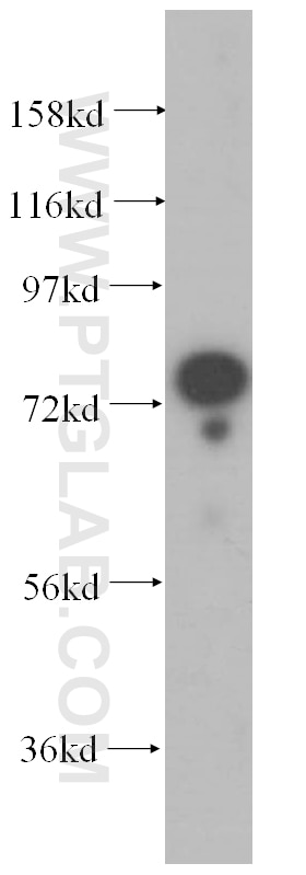 Western Blot (WB) analysis of human kidney tissue using GTPBP4 Polyclonal antibody (13897-1-AP)