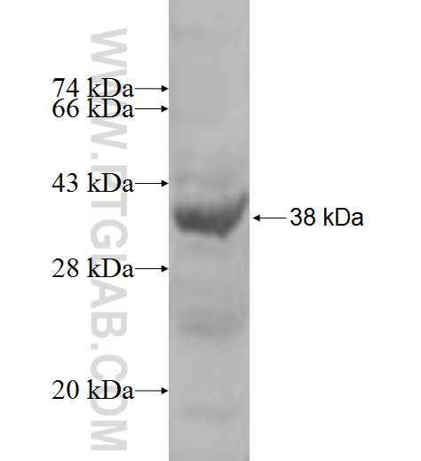 GTPBP4 fusion protein Ag4701 SDS-PAGE