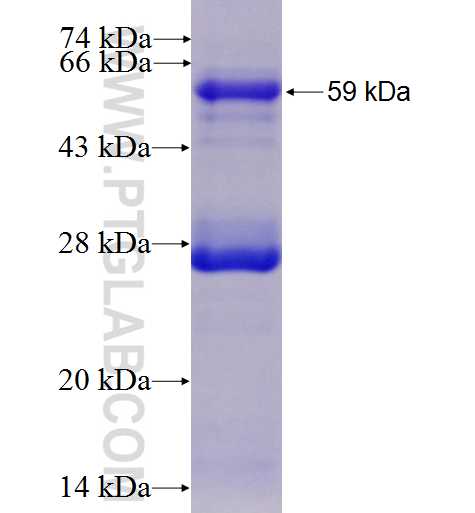 GTPBP4 fusion protein Ag4859 SDS-PAGE