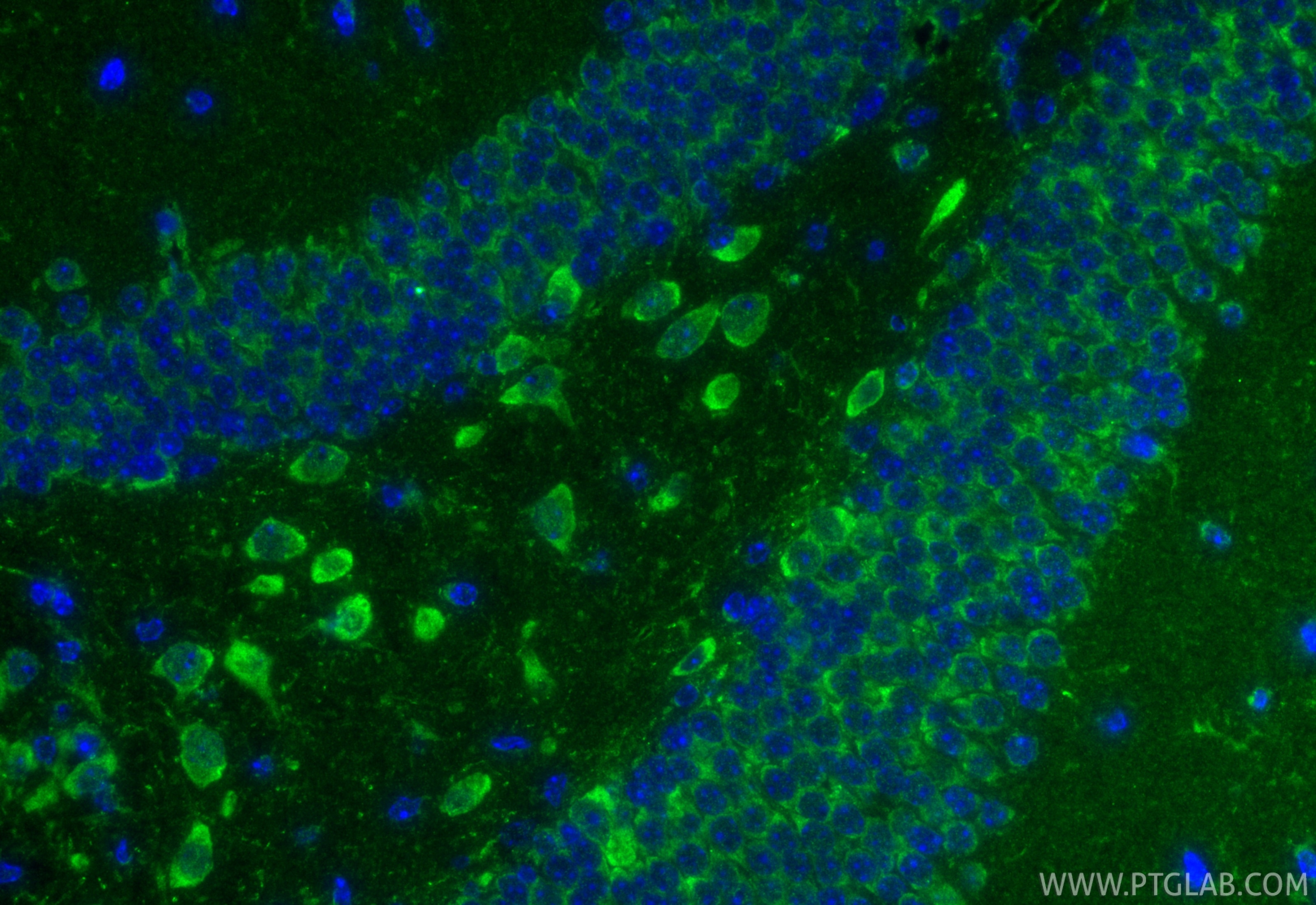 Immunofluorescence (IF) / fluorescent staining of mouse brain tissue using GTPBP5 Polyclonal antibody (20133-1-AP)