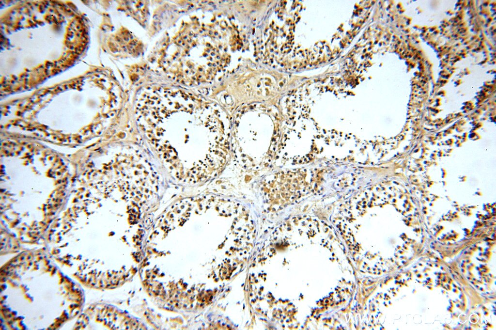 Immunohistochemistry (IHC) staining of human testis tissue using GTPBP5 Polyclonal antibody (20133-1-AP)