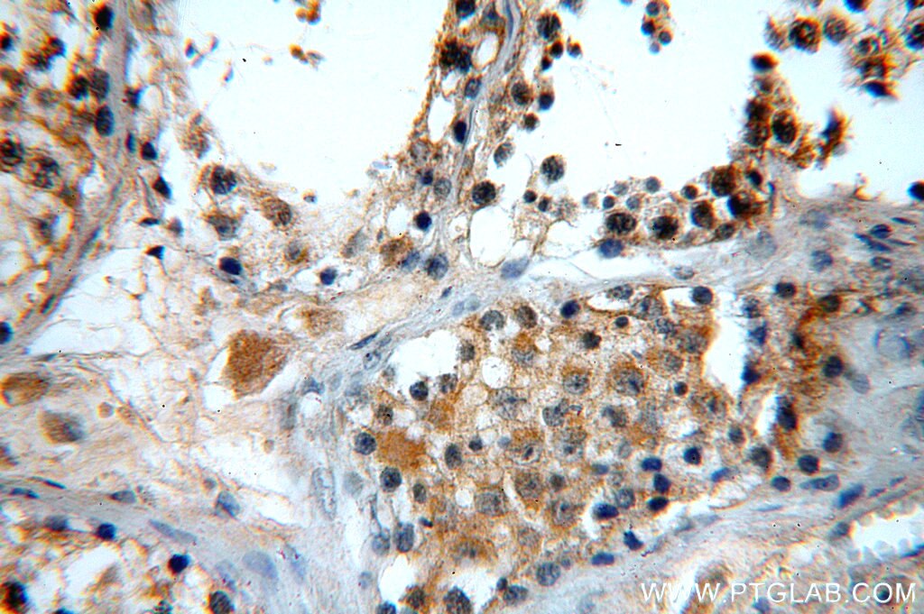 Immunohistochemistry (IHC) staining of human testis tissue using GTPBP5 Polyclonal antibody (20133-1-AP)