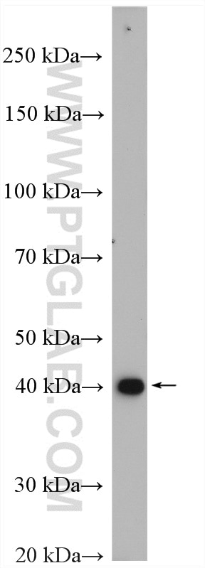 Western Blot (WB) analysis of LNCaP cells using GTPBP5 Polyclonal antibody (20133-1-AP)