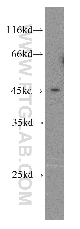 Western Blot (WB) analysis of Jurkat cells using GTPBP5 Polyclonal antibody (20133-1-AP)