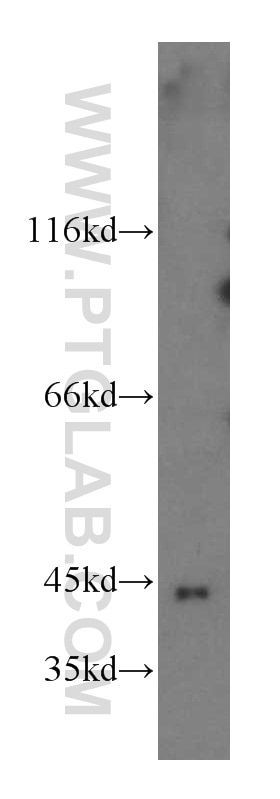 Western Blot (WB) analysis of Jurkat cells using GTPBP5 Polyclonal antibody (20133-1-AP)