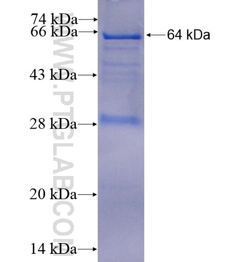 GTPBP5 fusion protein Ag14015 SDS-PAGE