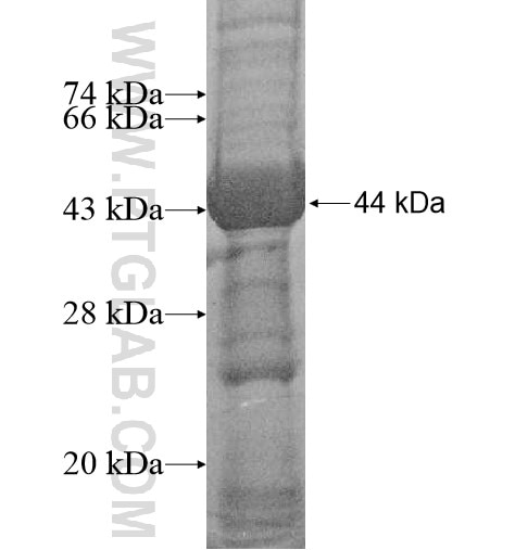 GTPBP5 fusion protein Ag14424 SDS-PAGE