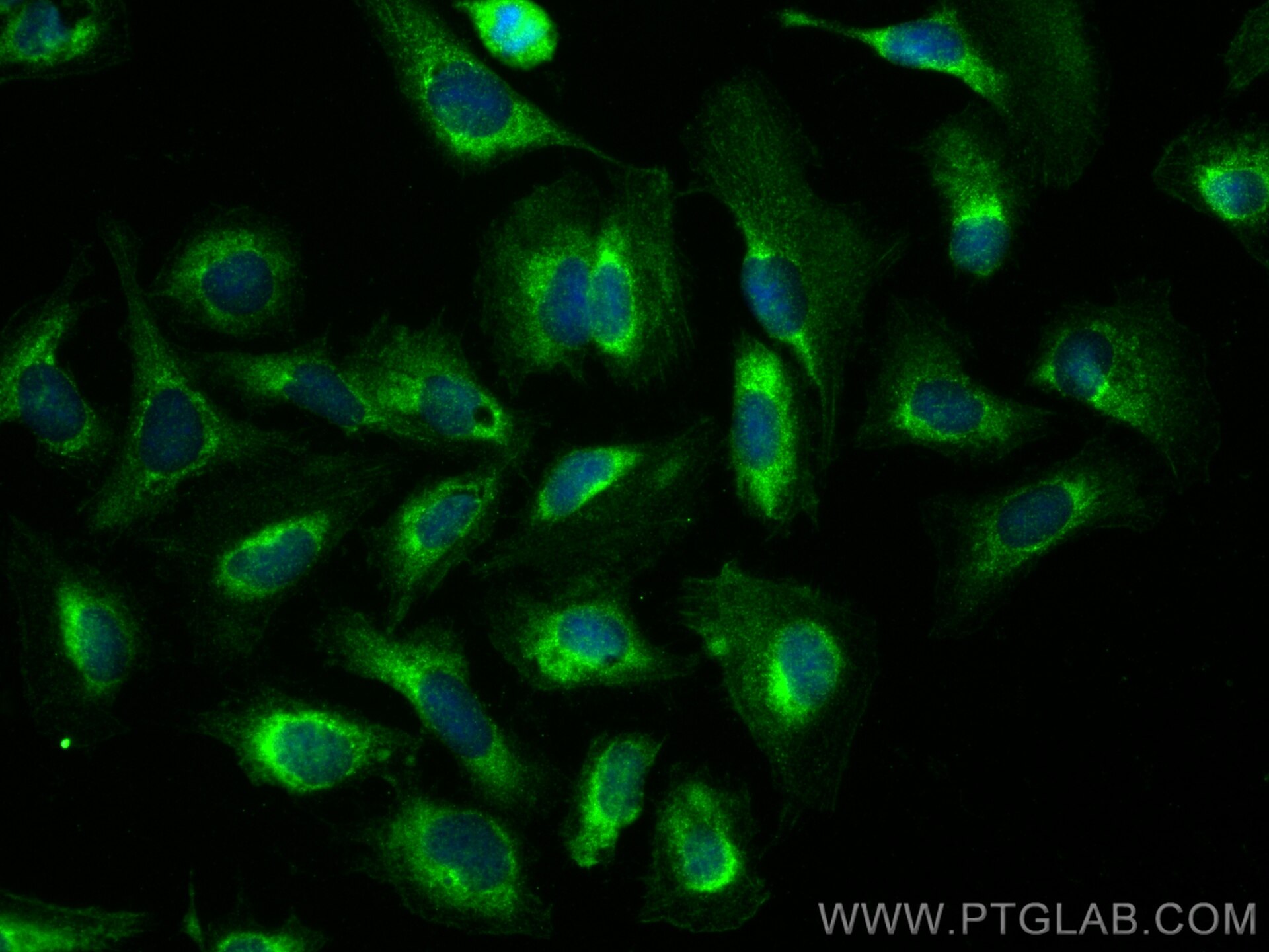 Immunofluorescent analysis of (-20°C Ethanol) fixed U2OS cells using GTPBP8 antibody (19813-1-AP) at dilution of 1:400 and CoraLite®488-Conjugated Goat Anti-Rabbit IgG(H+L) (SA00013-2). Immunofluorescence (IF) / fluorescent staining of U2OS cells using GTPBP8 Polyclonal antibody (19813-1-AP)