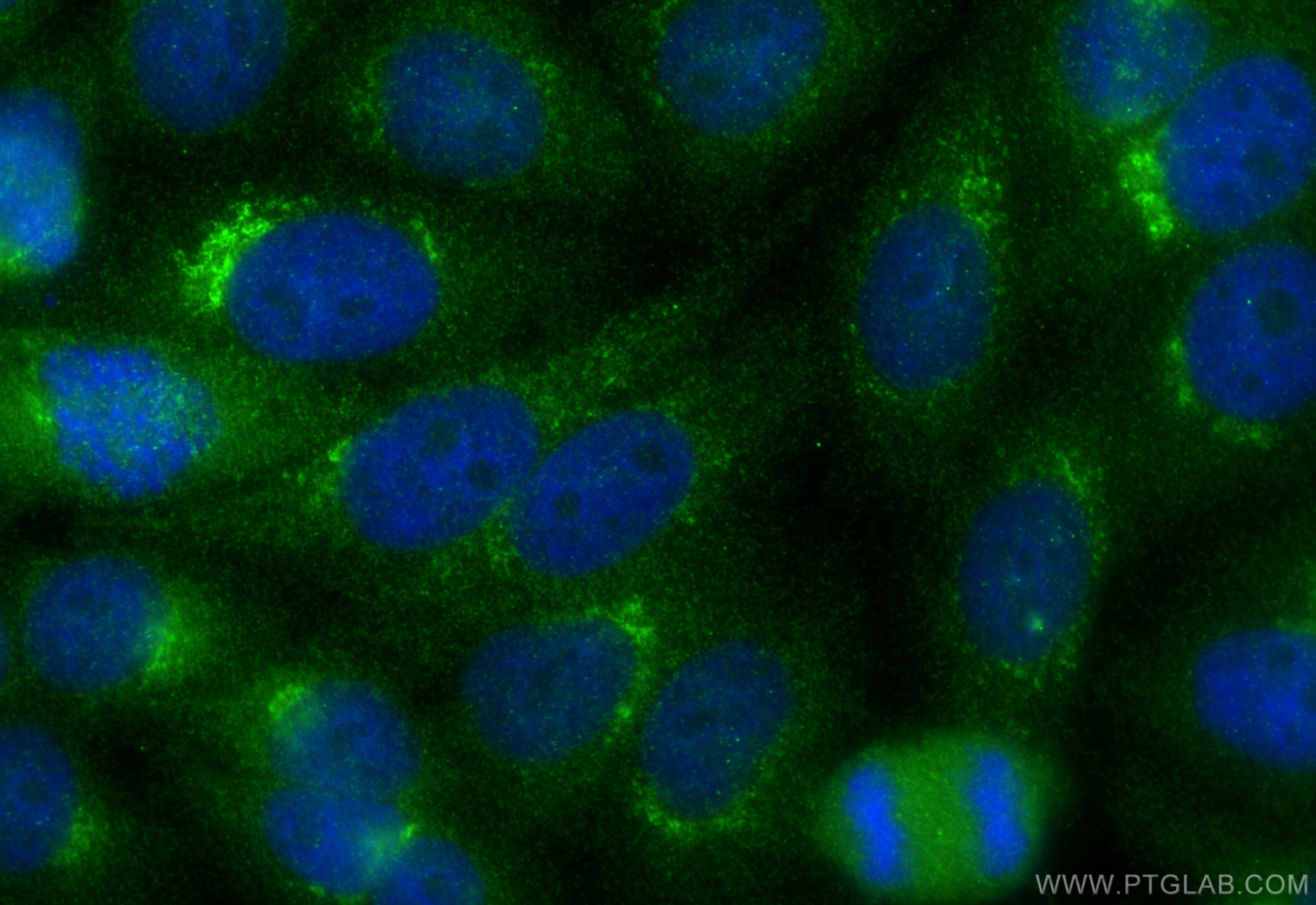 weak*2 Immunofluorescence (IF) / fluorescent staining of HepG2 cells using GTPBP8 Polyclonal antibody (19813-1-AP)