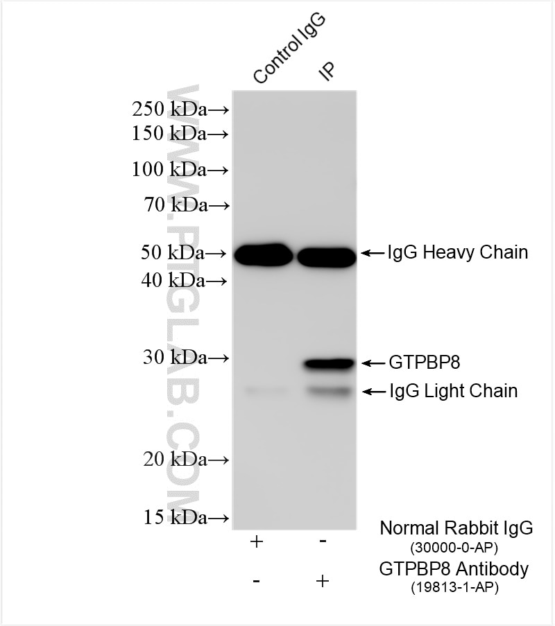 IP result of anti-GTPBP8 (IP:19813-1-AP, 4ug; Detection:19813-1-AP 1:500) with A549 cells lysate 1840 ug. Immunoprecipitation (IP) experiment of A549 cells using GTPBP8 Polyclonal antibody (19813-1-AP)
