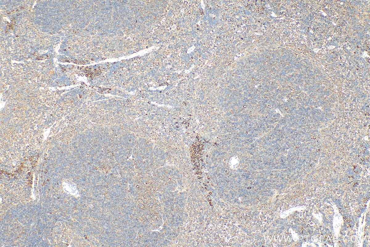 Immunohistochemistry (IHC) staining of mouse spleen tissue using GTSE1 Polyclonal antibody (21319-1-AP)