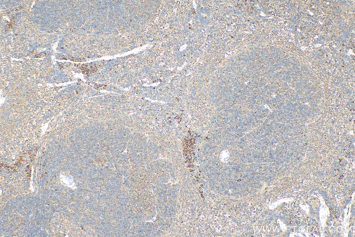 Immunohistochemistry (IHC) staining of mouse spleen tissue using GTSE1 Polyclonal antibody (21319-1-AP)