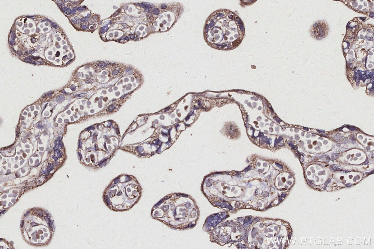 Immunohistochemistry (IHC) staining of human placenta tissue using GTSE1 Polyclonal antibody (21319-1-AP)