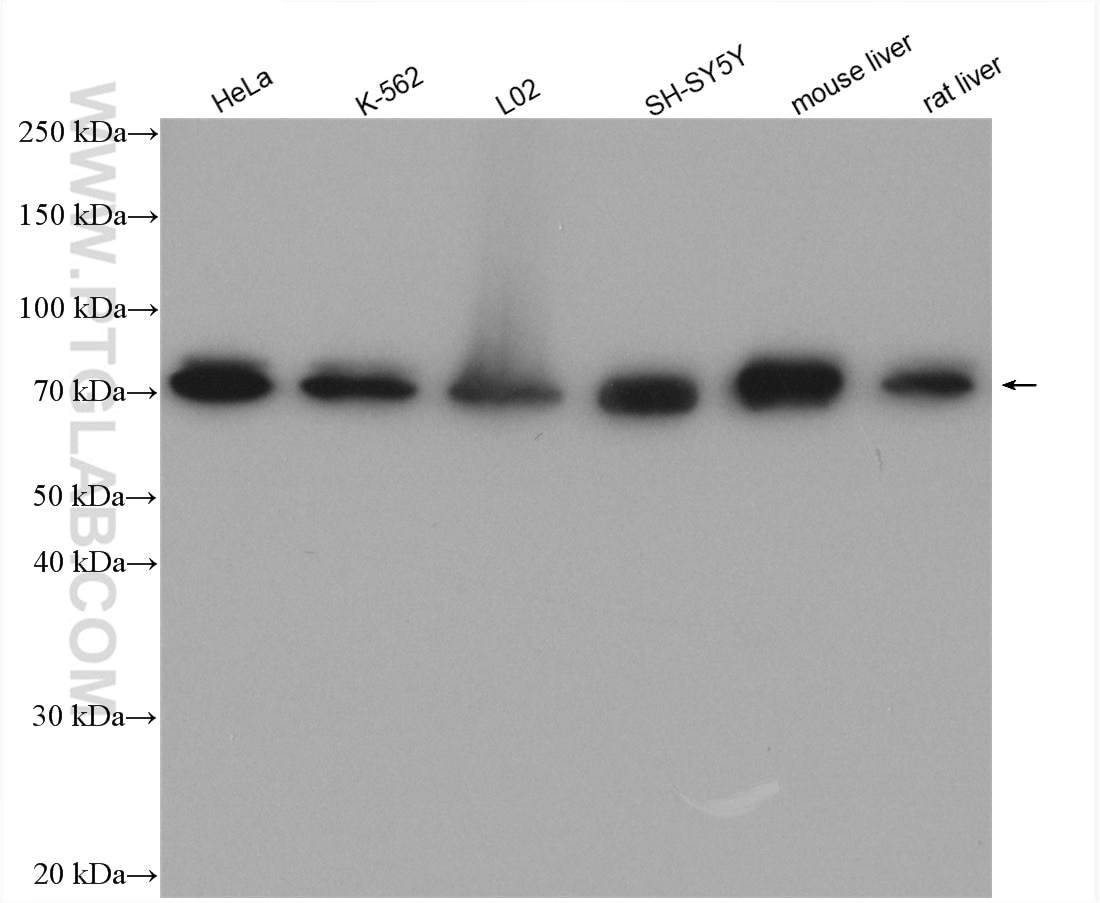 Western Blot (WB) analysis of various lysates using GTSE1 Polyclonal antibody (21319-1-AP)