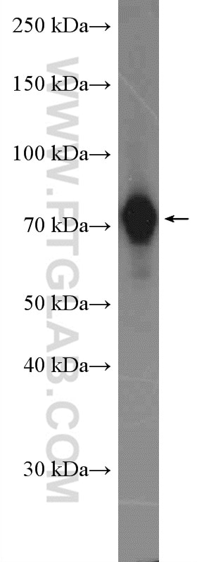 Western Blot (WB) analysis of HeLa cells using GTSE1 Polyclonal antibody (21319-1-AP)