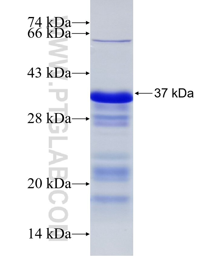 GTSE1 fusion protein Ag32817 SDS-PAGE