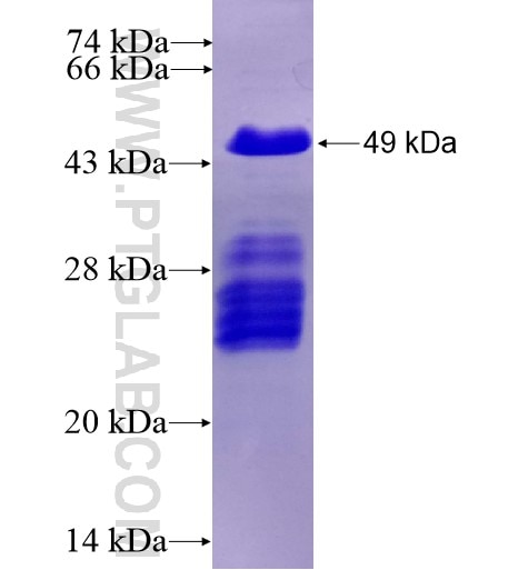 GTSE1 fusion protein Ag13497 SDS-PAGE