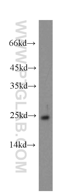 Western Blot (WB) analysis of Y79 cells using GCAP1 Polyclonal antibody (12944-1-AP)