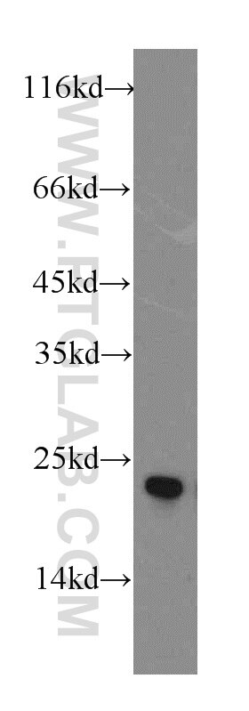 Western Blot (WB) analysis of Y79 cells using GCAP1 Polyclonal antibody (12944-1-AP)