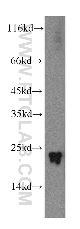 Western Blot (WB) analysis of Y79 cells using GCAP1 Polyclonal antibody (12944-1-AP)