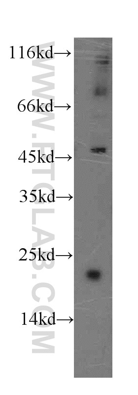 Western Blot (WB) analysis of MCF-7 cells using GCAP1 Polyclonal antibody (12944-1-AP)