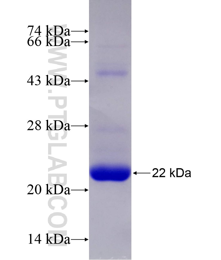 GUCA1A fusion protein Ag14410 SDS-PAGE