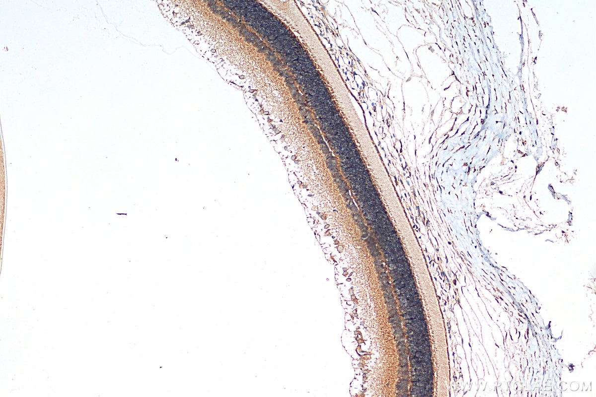 Immunohistochemistry (IHC) staining of rat eye tissue using GUCA1C Polyclonal antibody (21531-1-AP)