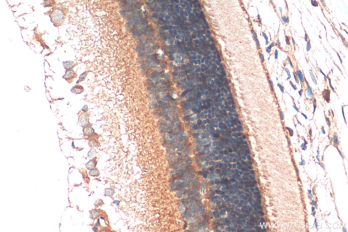 Immunohistochemistry (IHC) staining of rat eye tissue using GUCA1C Polyclonal antibody (21531-1-AP)