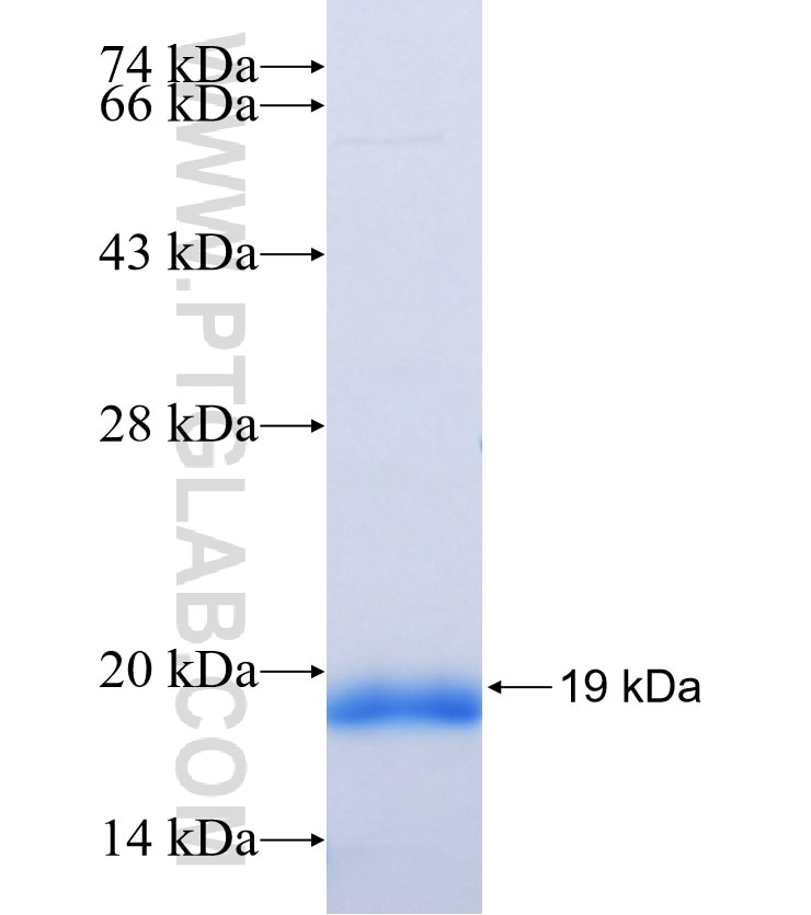 GUCA2A fusion protein Ag37495 SDS-PAGE